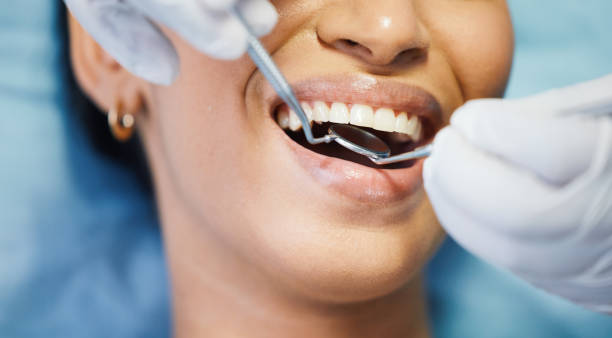 Best Emergency Root Canal Treatment in Lapwai, ID