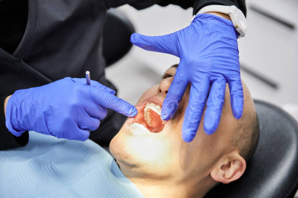 Best Emergency Broken Tooth Repair in Lapwai, ID